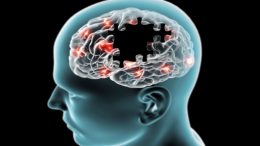 Alzheimer